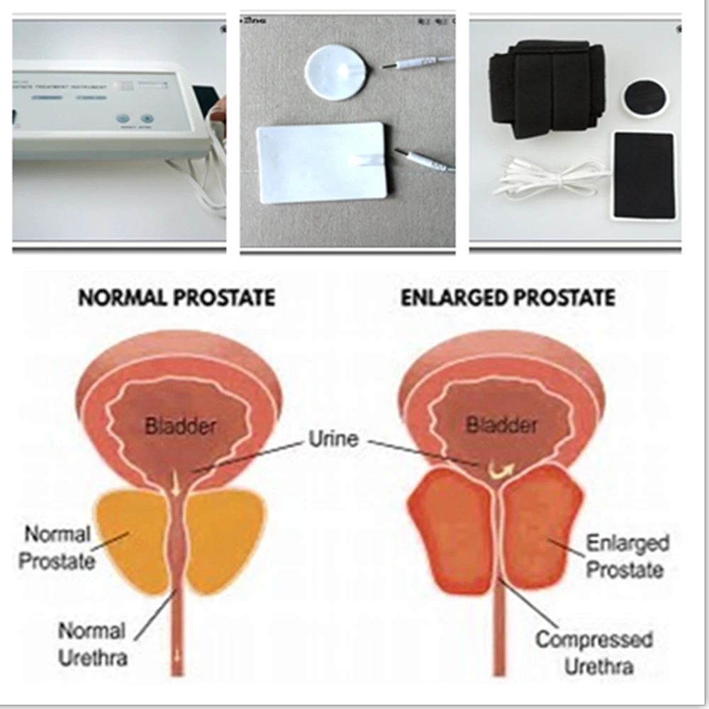 Massageador Prostático Poderos - Therapy Health And Wellness avaliação e preço